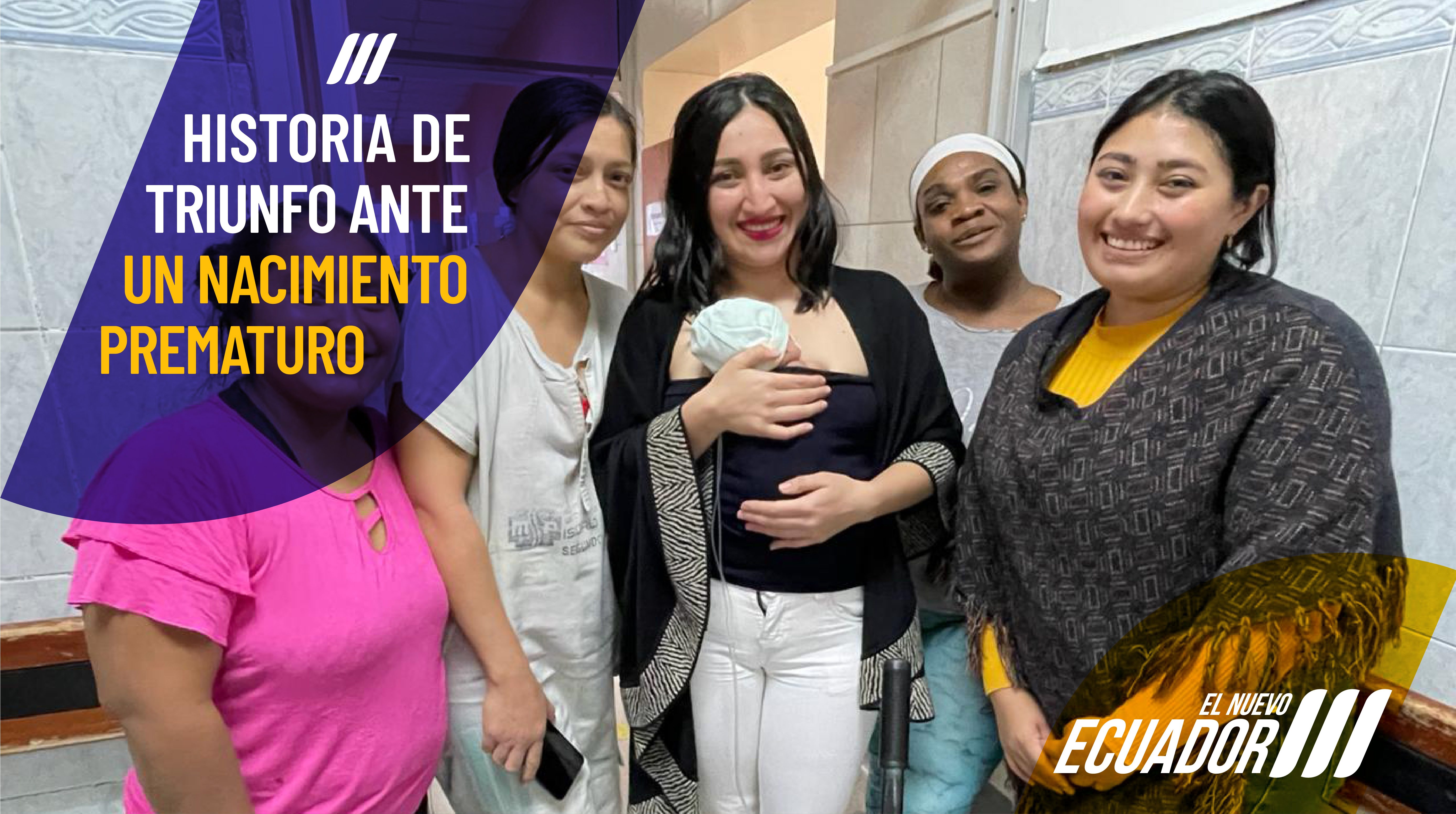 Prematuro extremo 25 semanas